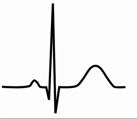 ECG animation widget